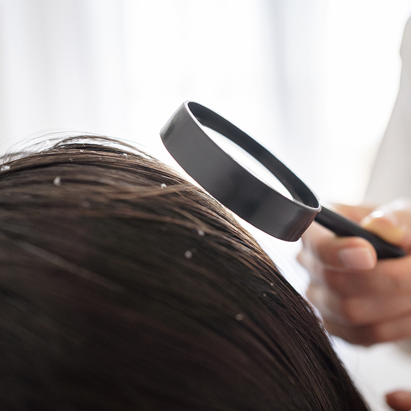 Dermoasesoría capilar Esplugues del Llobregat Farmacia La Mallola